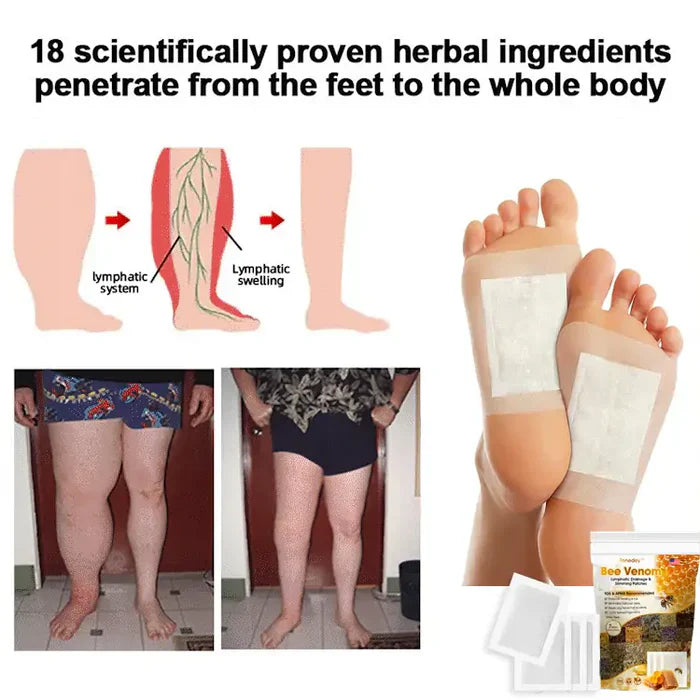 Cheemex® Natural Bee Toxin Foot Patches — Slim, Soothe & Feel Amazing (Free Oil Included!)