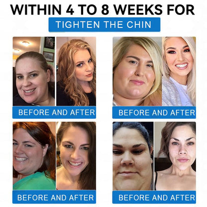 🔥 Last Chance! Grunsify® Patch melts 20lbs fast—No shots, no sweat! 80% OFF!